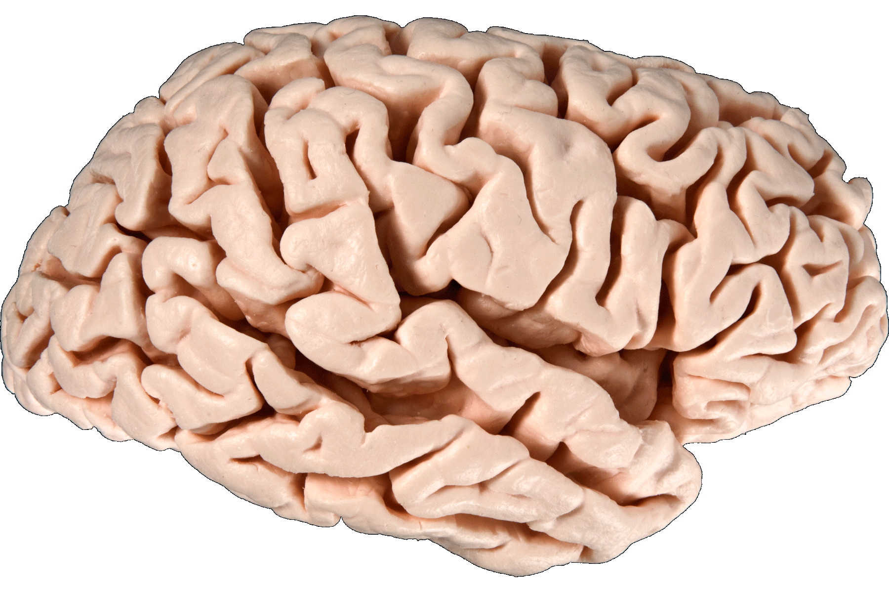 Right hemisphere